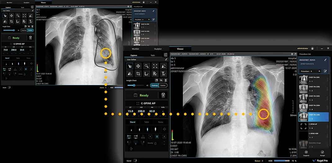 DiRuxView X-ray